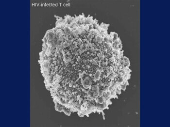 HIV（ヒト免疫不全）ウイルス